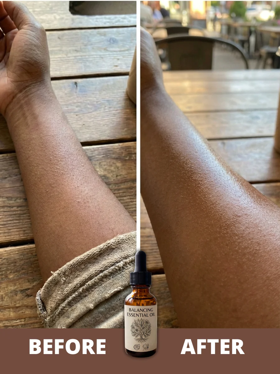 Balancing Essential Oil-(SKIN) - Image 3