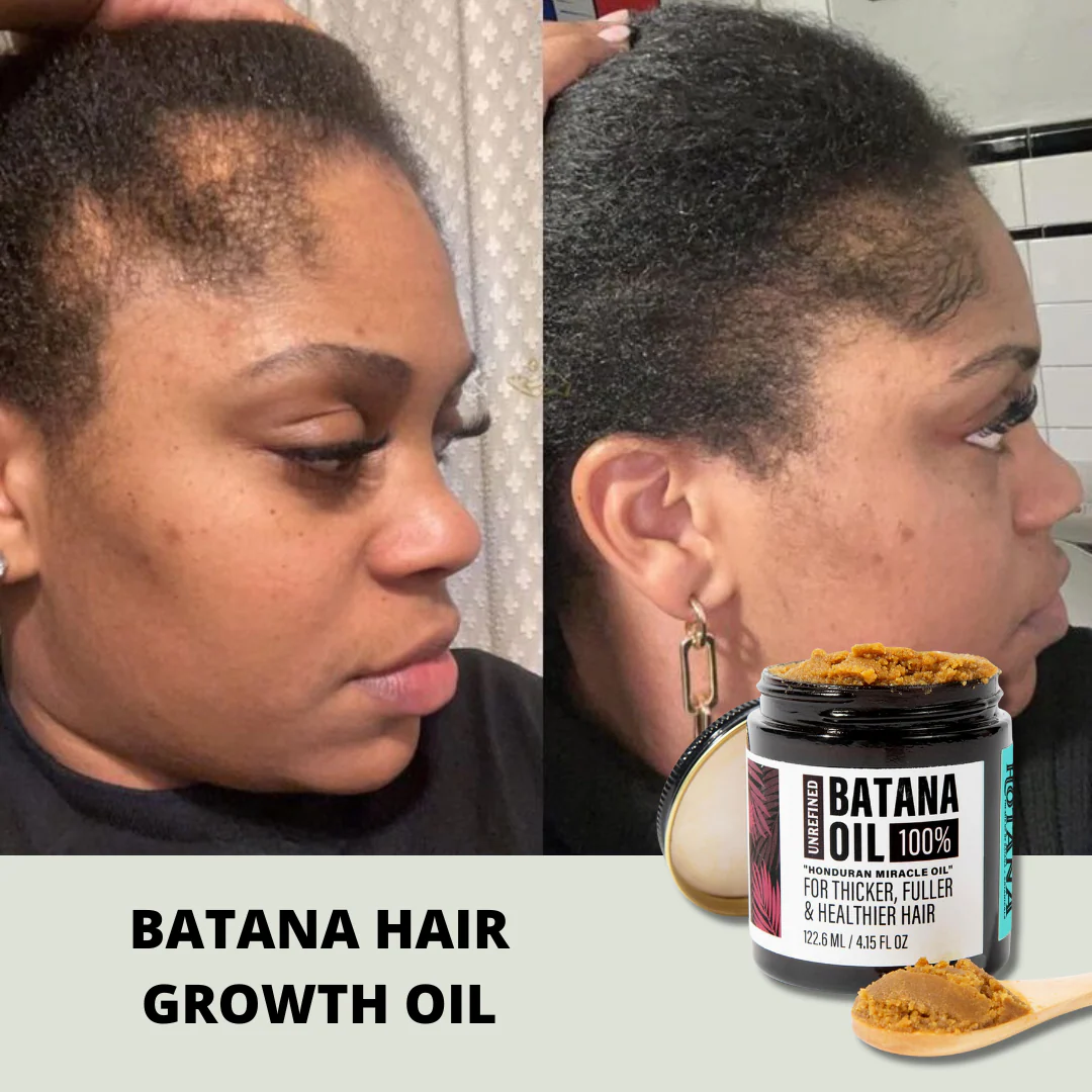 Batana Hair Growth Oil - Image 2