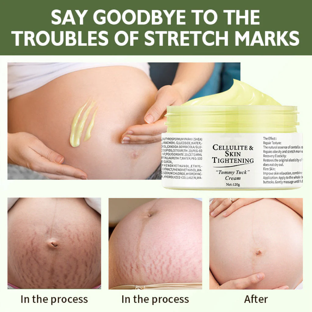 Cellulite&Skin Tightening - Image 4