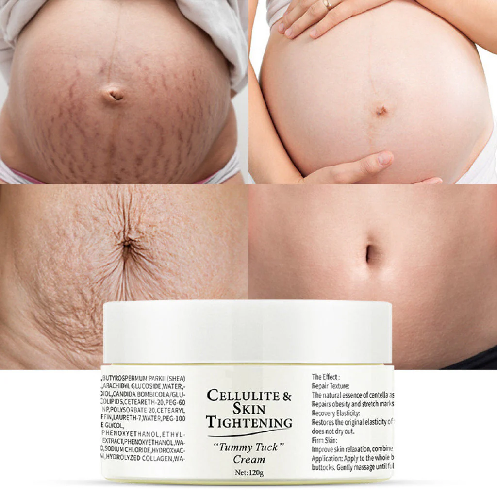 Cellulite&Skin Tightening - Image 8