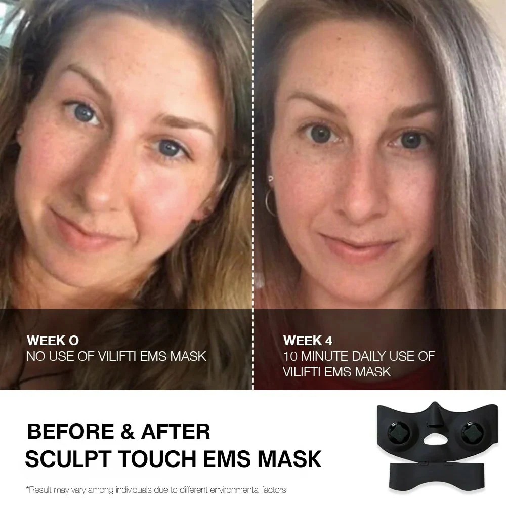 Face-Lifting EMS Mask - Image 7