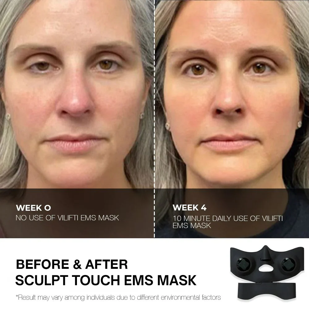Face-Lifting EMS Mask - Image 8