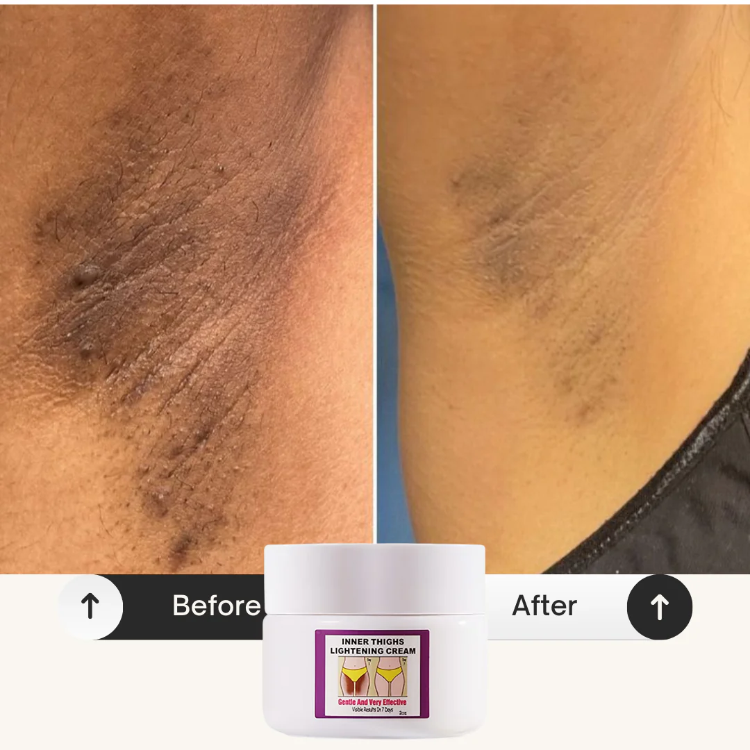 Inner Thighs Lightening Cream - Image 3