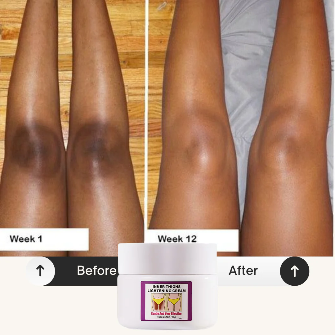Inner Thighs Lightening Cream - Image 4