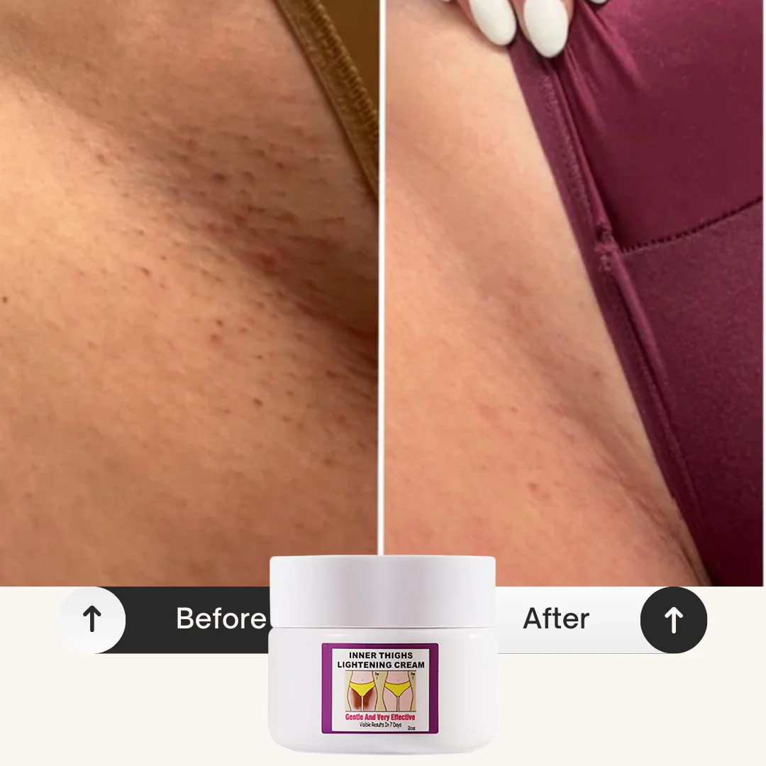 Inner Thighs Lightening Cream - Image 5