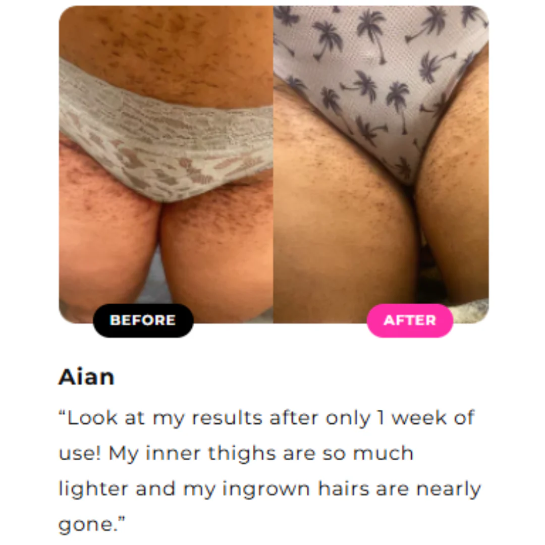 Inner Thighs Lightening Cream - Image 6