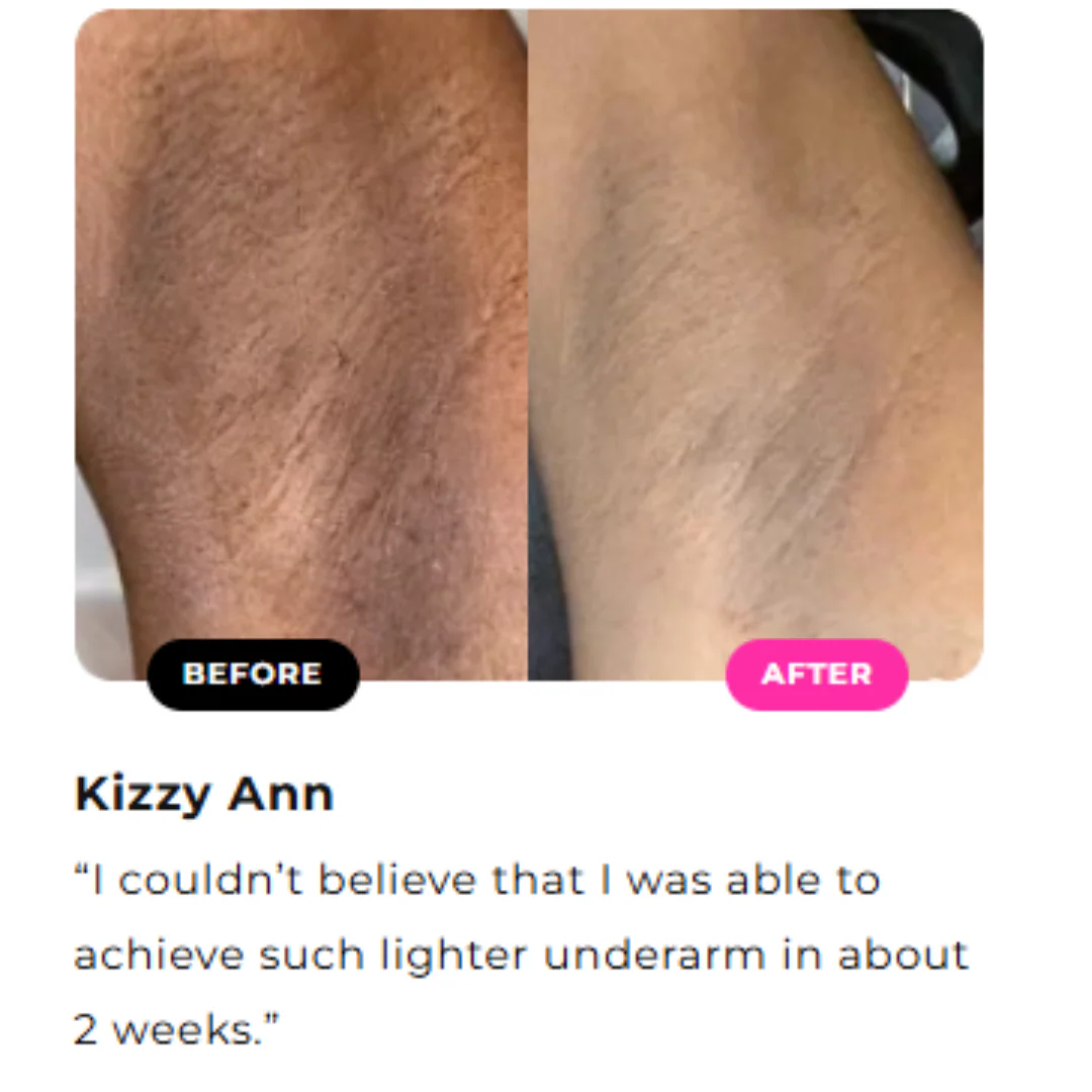 Inner Thighs Lightening Cream - Image 7