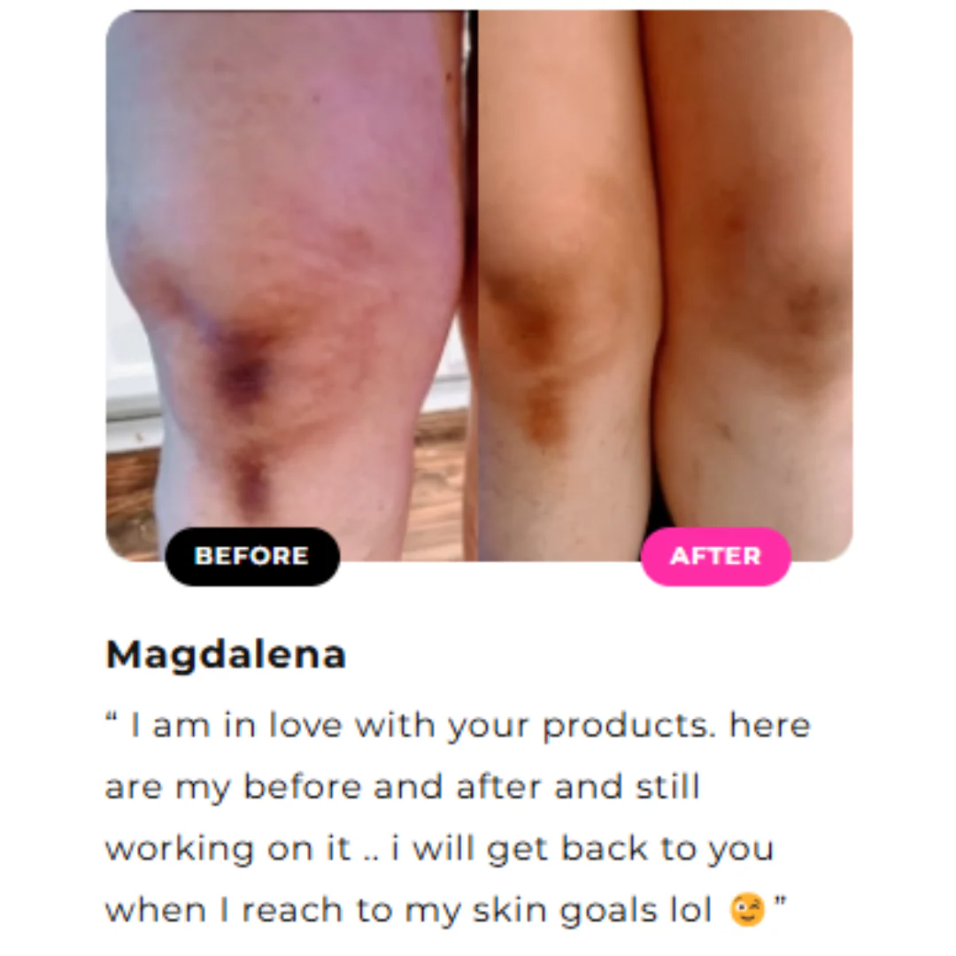 Inner Thighs Lightening Cream - Image 8