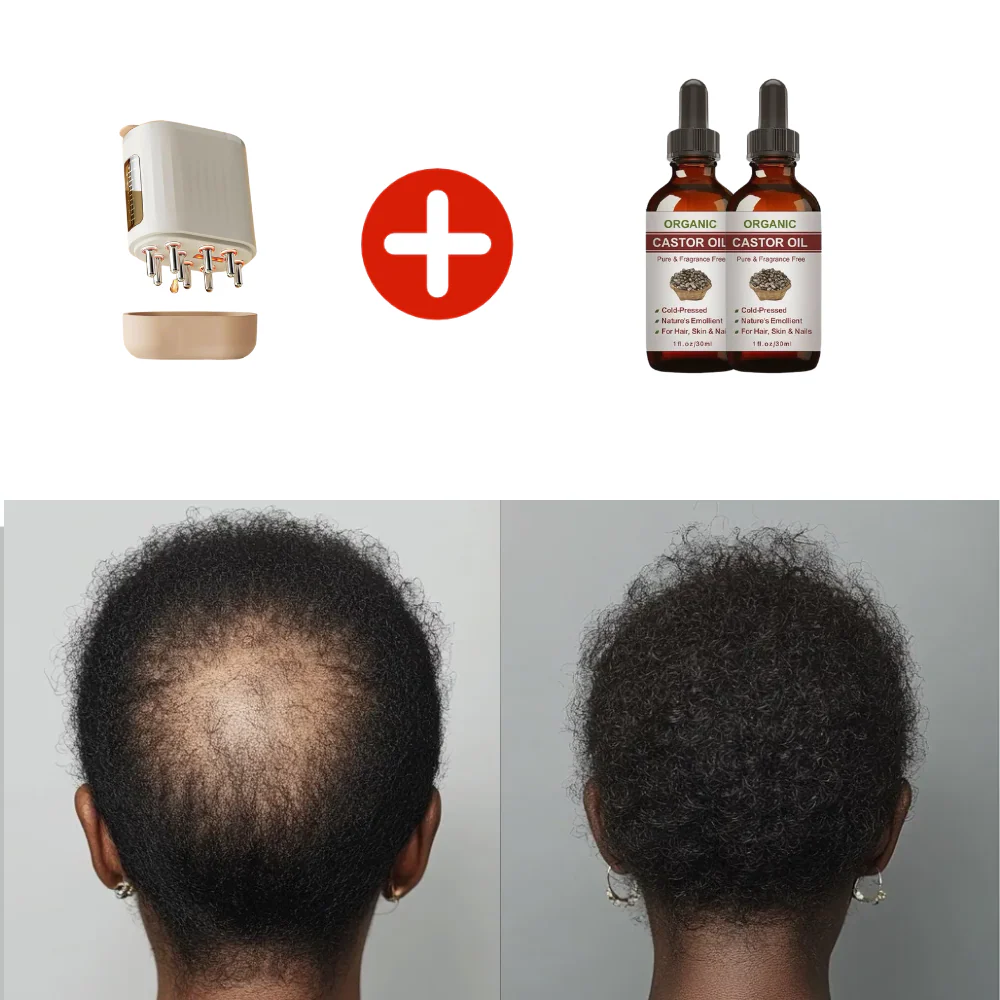 Laser Scalp Therapy Comb - Image 9
