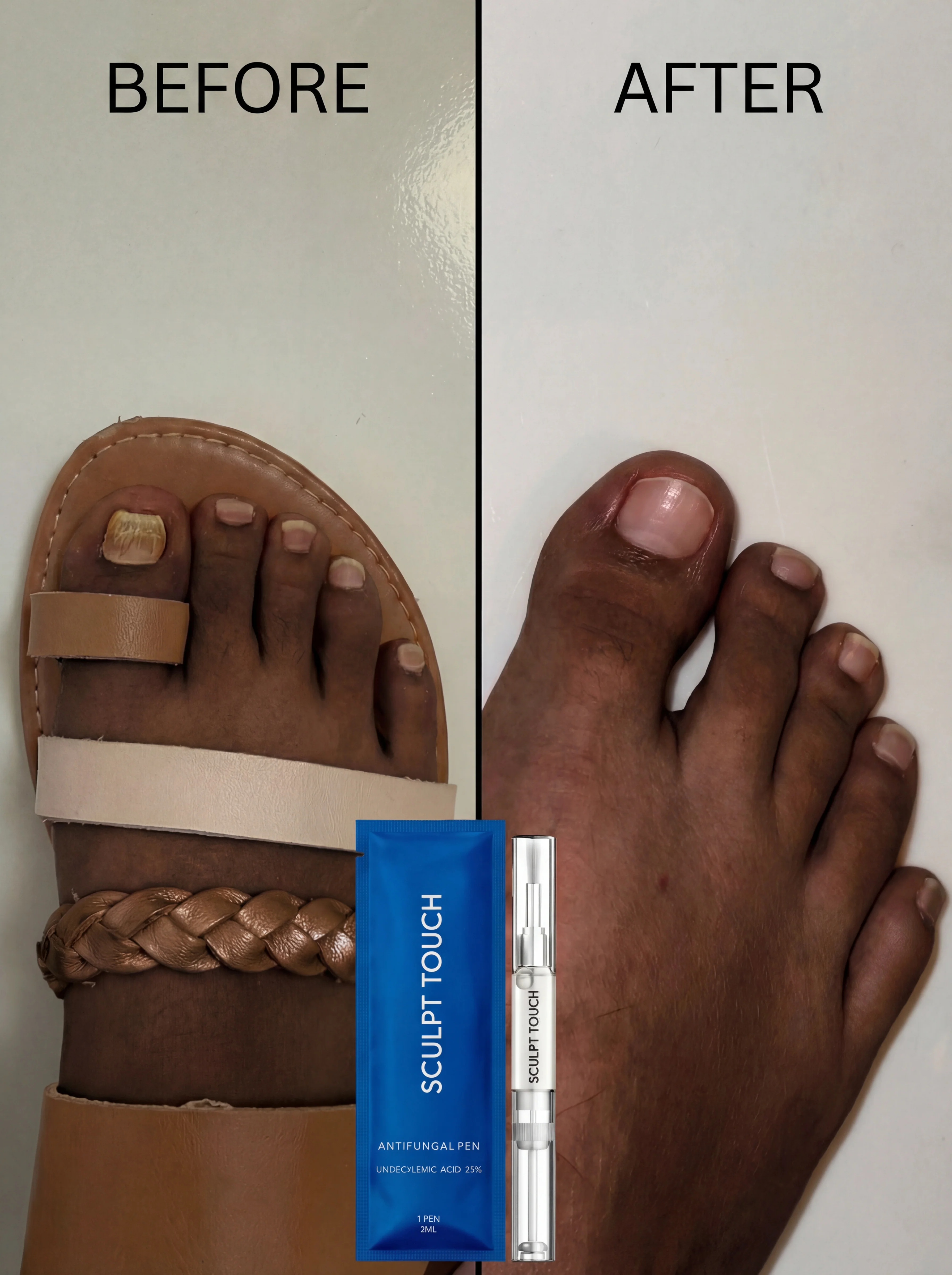 Lunavia Fungus Cure