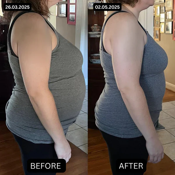 Sculpt Touch™ Belly Fat Patches - Image 10