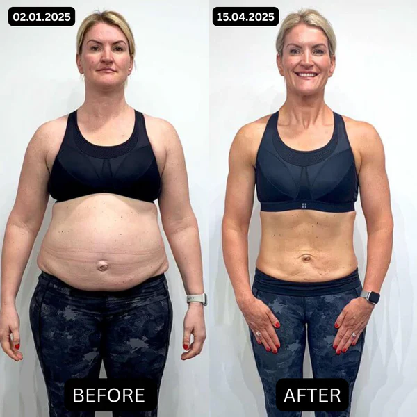 Sculpt Touch™ Belly Fat Patches - Image 7