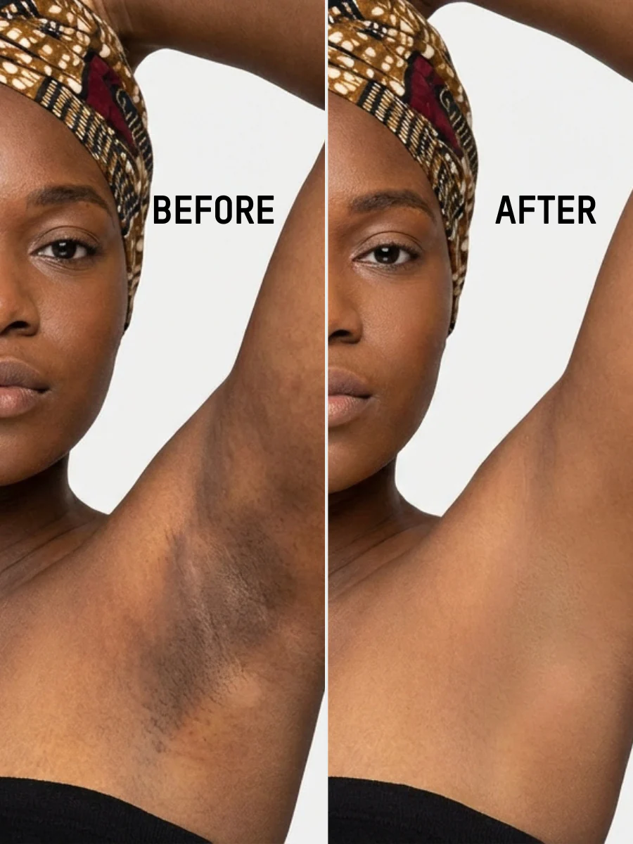 Brighten Dark Spots Face Pads - Image 3