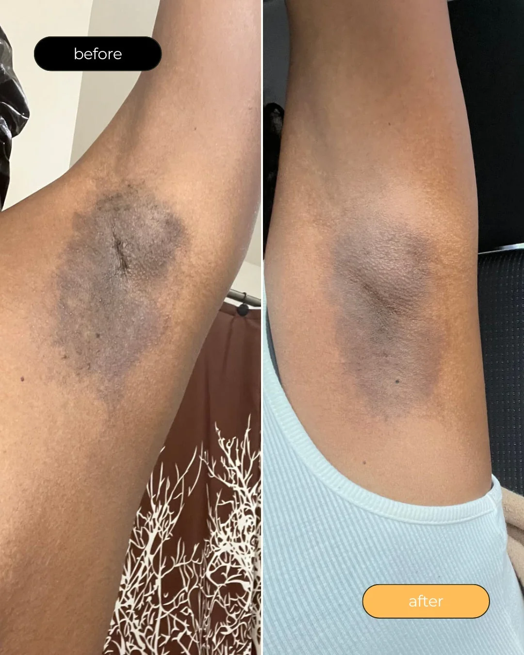 Turmeric Dark Spot Assasin Scrub - Image 3