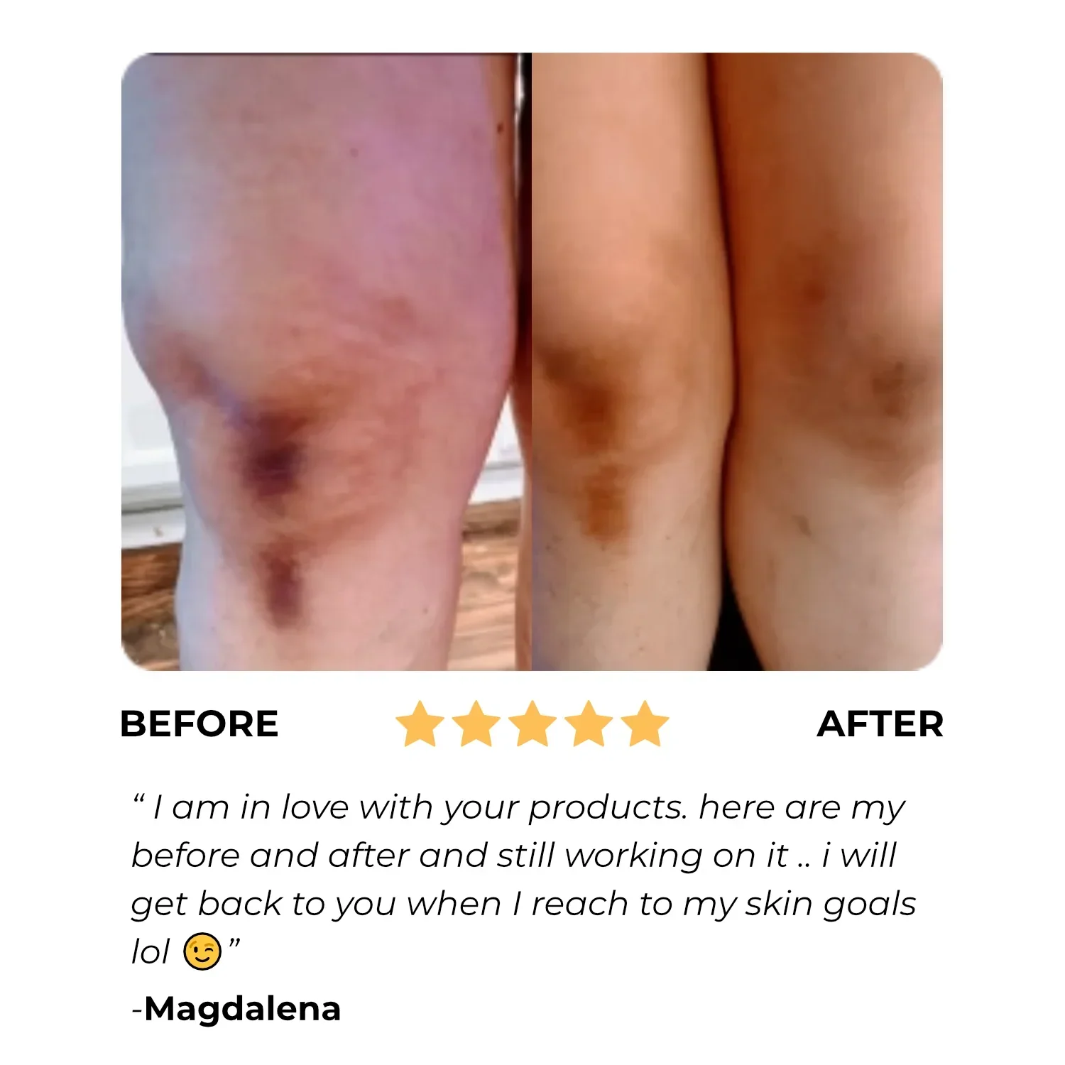 Turmeric Dark Spot Assasin Scrub - Image 6